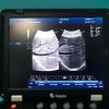 128 Item 3D Medical THI Ultrasound Machine For Sale With Convex Probe YR05148 - Image 3